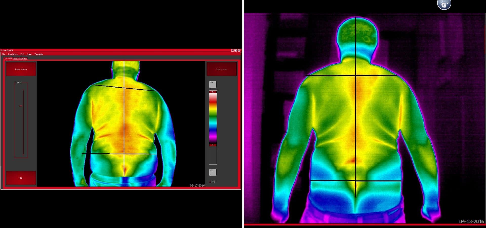 Breast Thermography International - Breast Thermography International