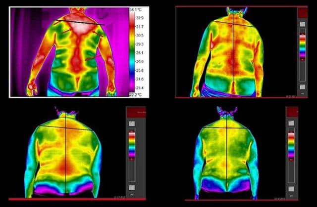 Breast Thermography, medical thermography,Certified Thermographic Technician,Infrared breast health imaging,BTI Turnkey Thermography,Chiropractic Thermography,Medical Thermography Experts,Medical Thermography,thermography services,Thermography,Thermal Imaging Analysis