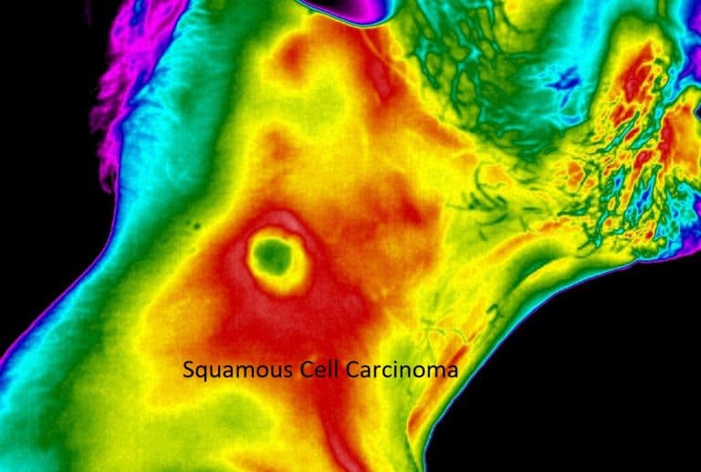 Breast Thermography, medical thermography,Certified Thermographic Technician,Infrared breast health imaging,BTI Turnkey Thermography,Chiropractic Thermography,Medical Thermography Experts,Medical Thermography,thermography services,Thermography,Thermal Imaging Analysis